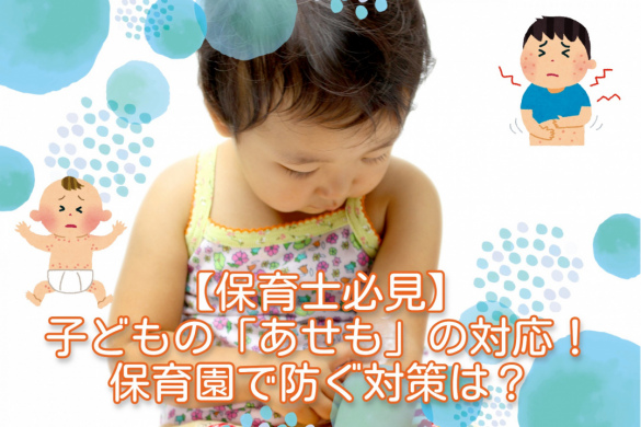 【保育士必見】子どもの「あせも」の対応！保育園で防ぐ対策は？